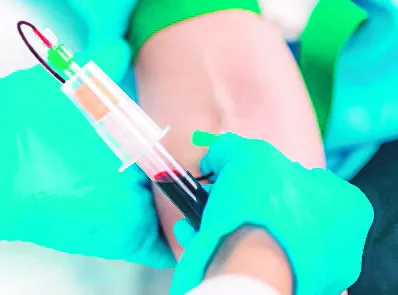 Para el 2025 se busca reducir la prevalencia.