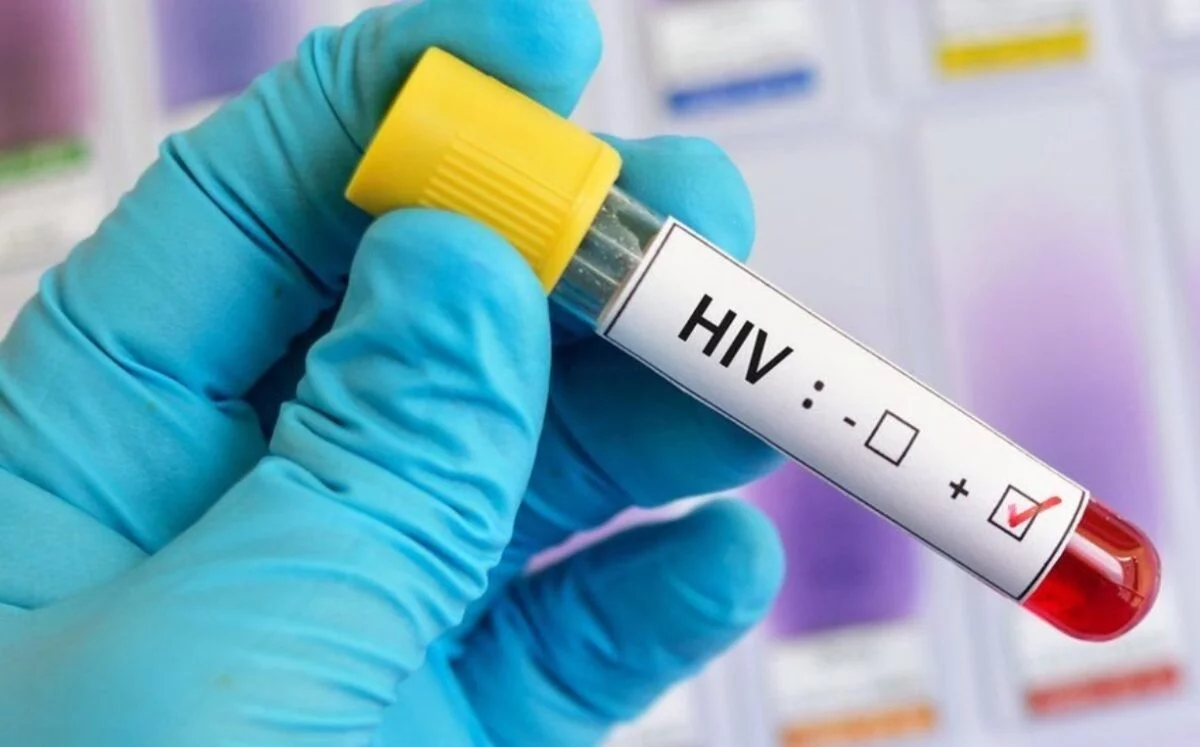 Un gran desafío es  lograr tener una visión sin estigma, pues limita mucho a este  paciente.